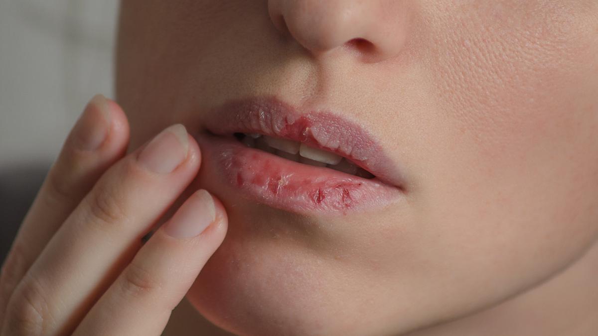Efek Samping Menggunakan Lipstik Tidak BPOM 